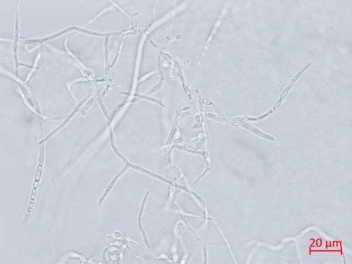 Microdochium_sp_1