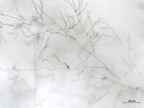 Rhizoctonia_sp_5