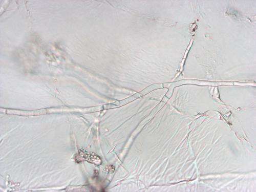 Sclerotium cepivorum