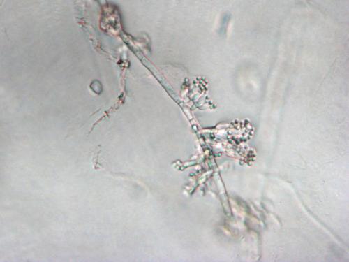 Sclerotium cepivorum conidiophores