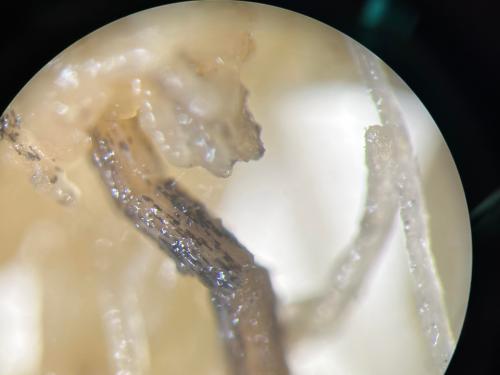 Chlamydospore de Berkeleyomyces sp. (syn. Thielaviopsis) racines cannabis