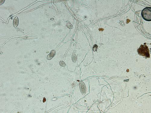 Phytophthora infestans