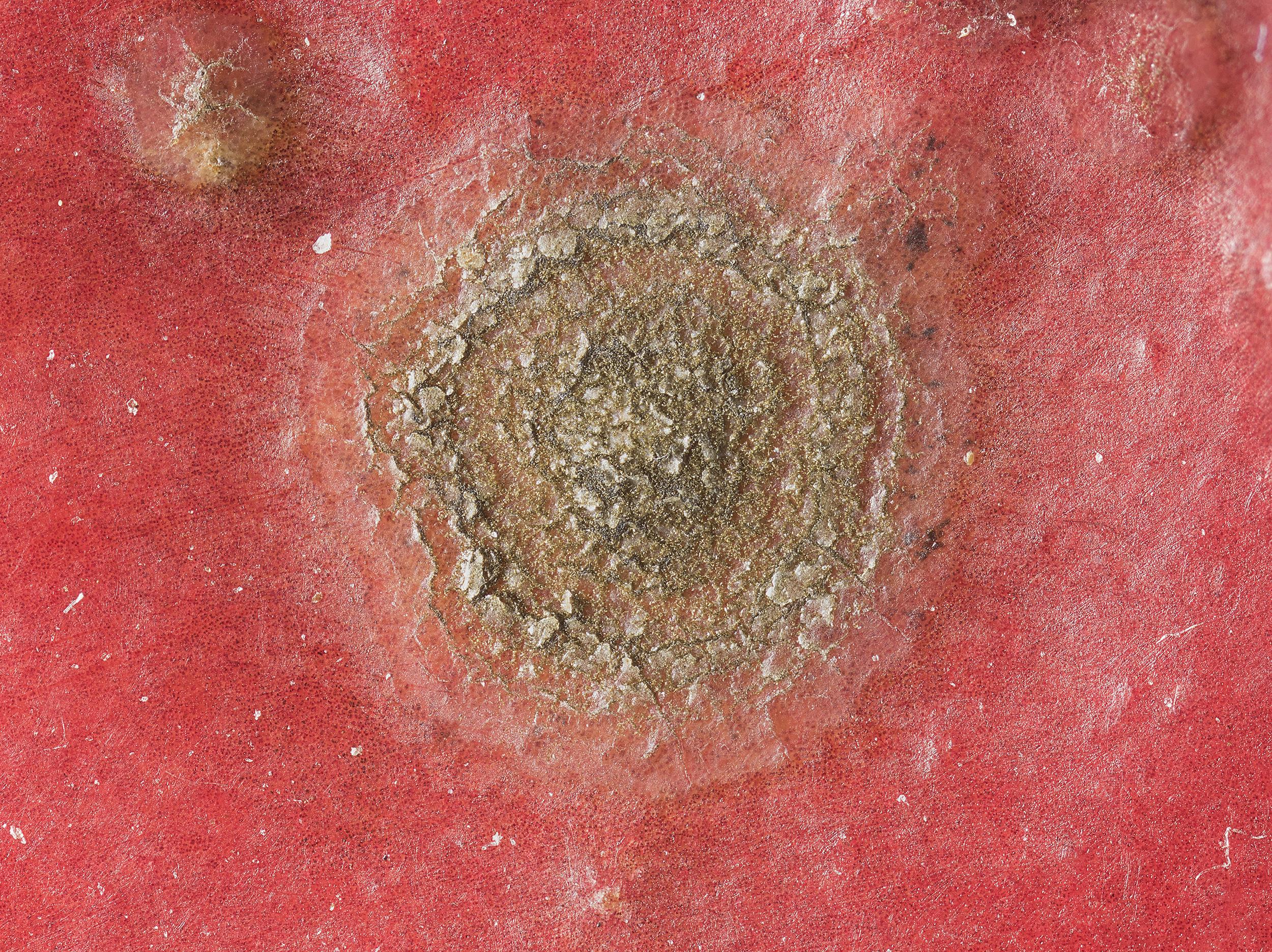 Pomme - Tavelure (Venturia inaequalis)_10