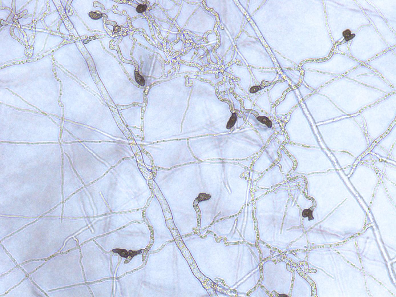 Colletotrichum_Appressoria_D50604-2_LQ