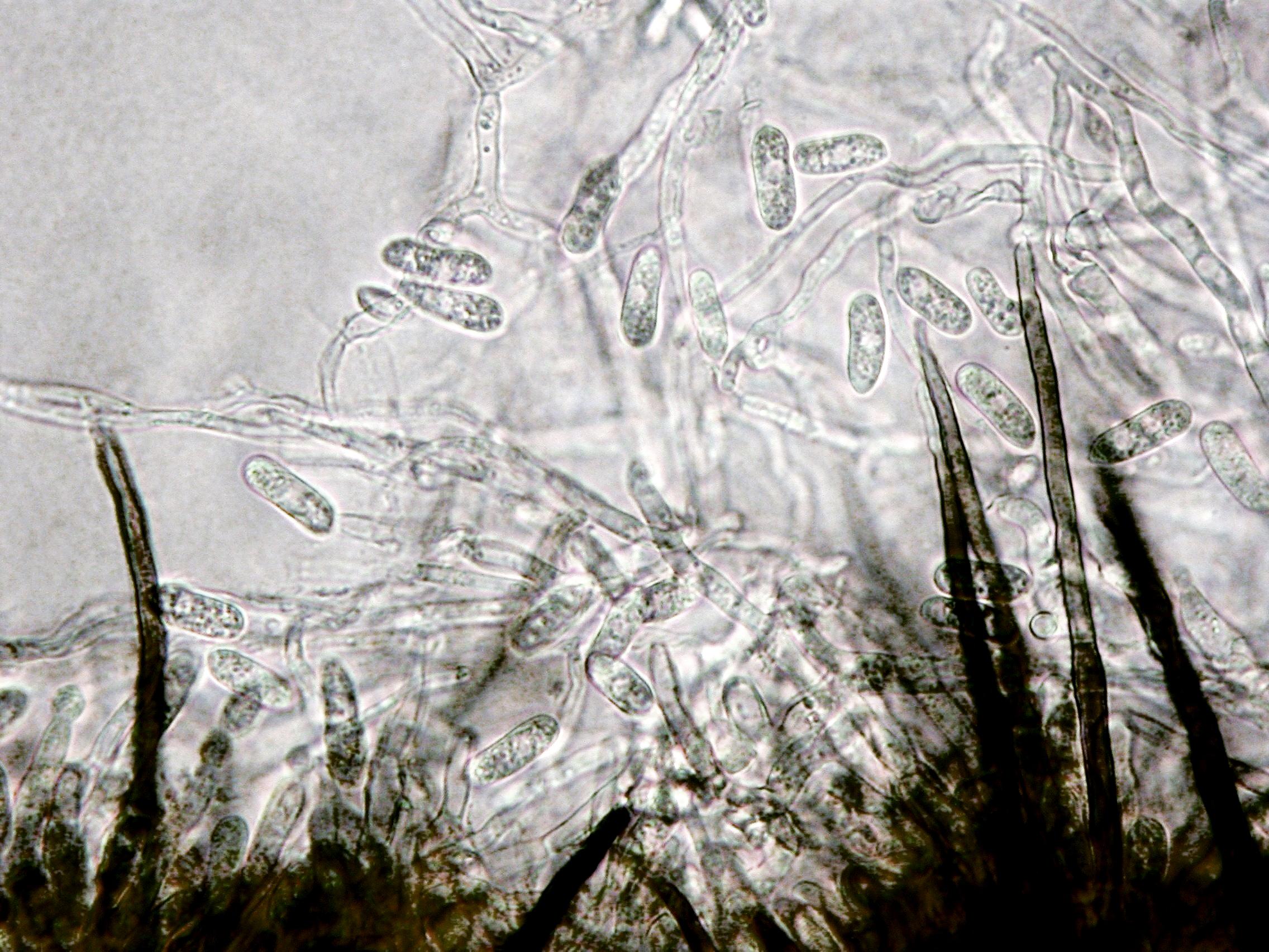 Colletotrichum_malvarum-02