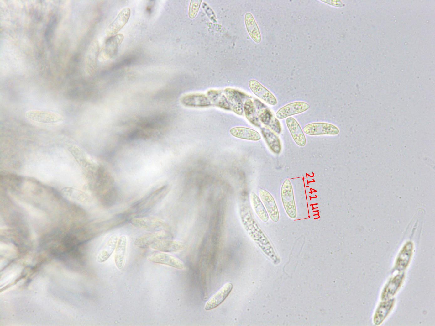 Glomerella_sp_1