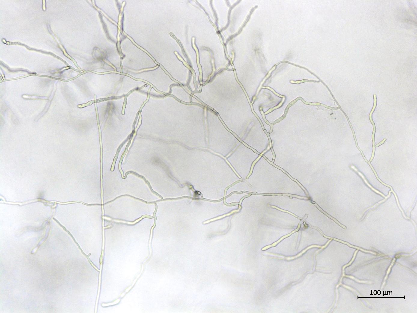Rhizoctonia_sp_5