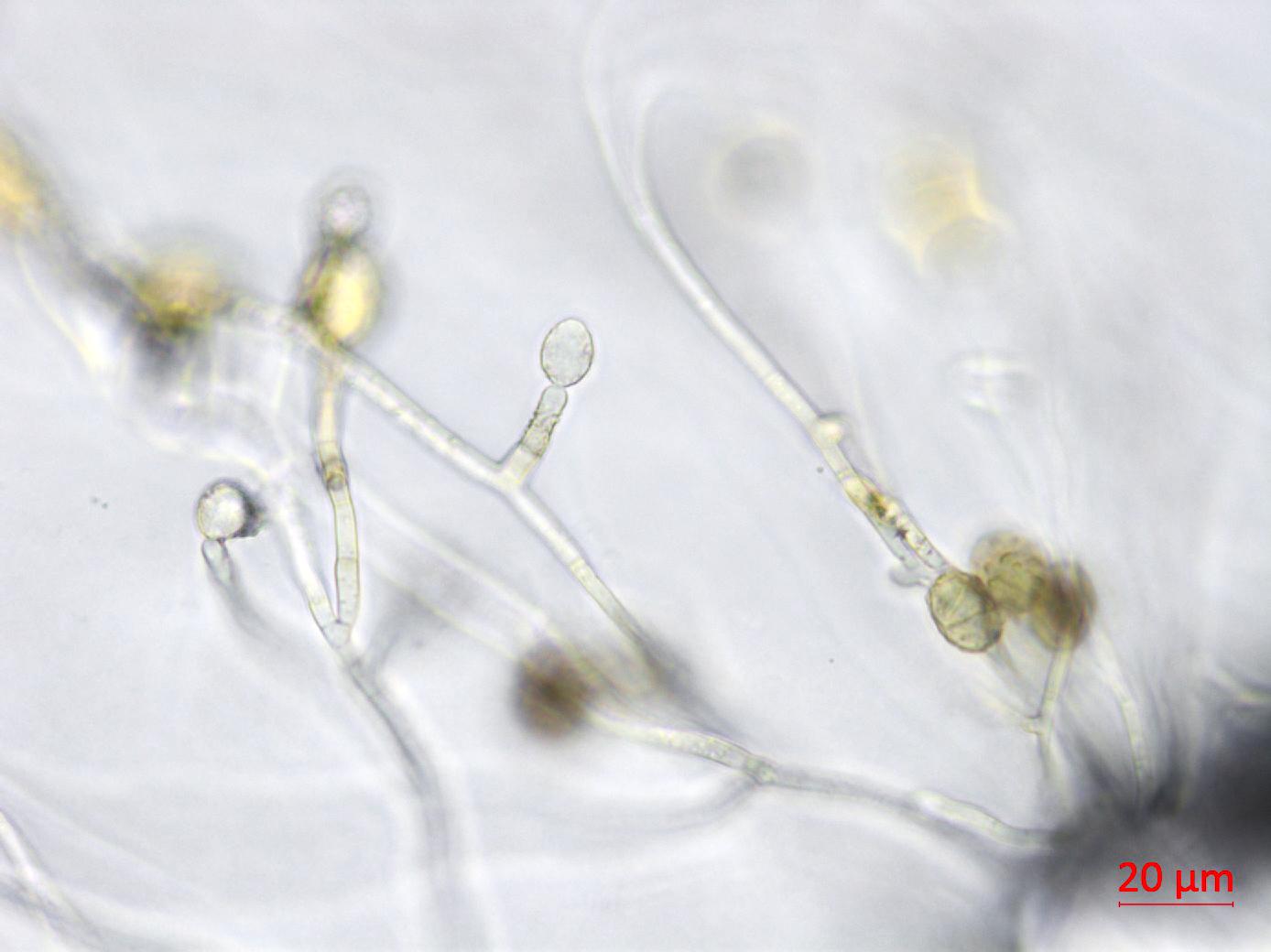 Ulocladium_sp_3