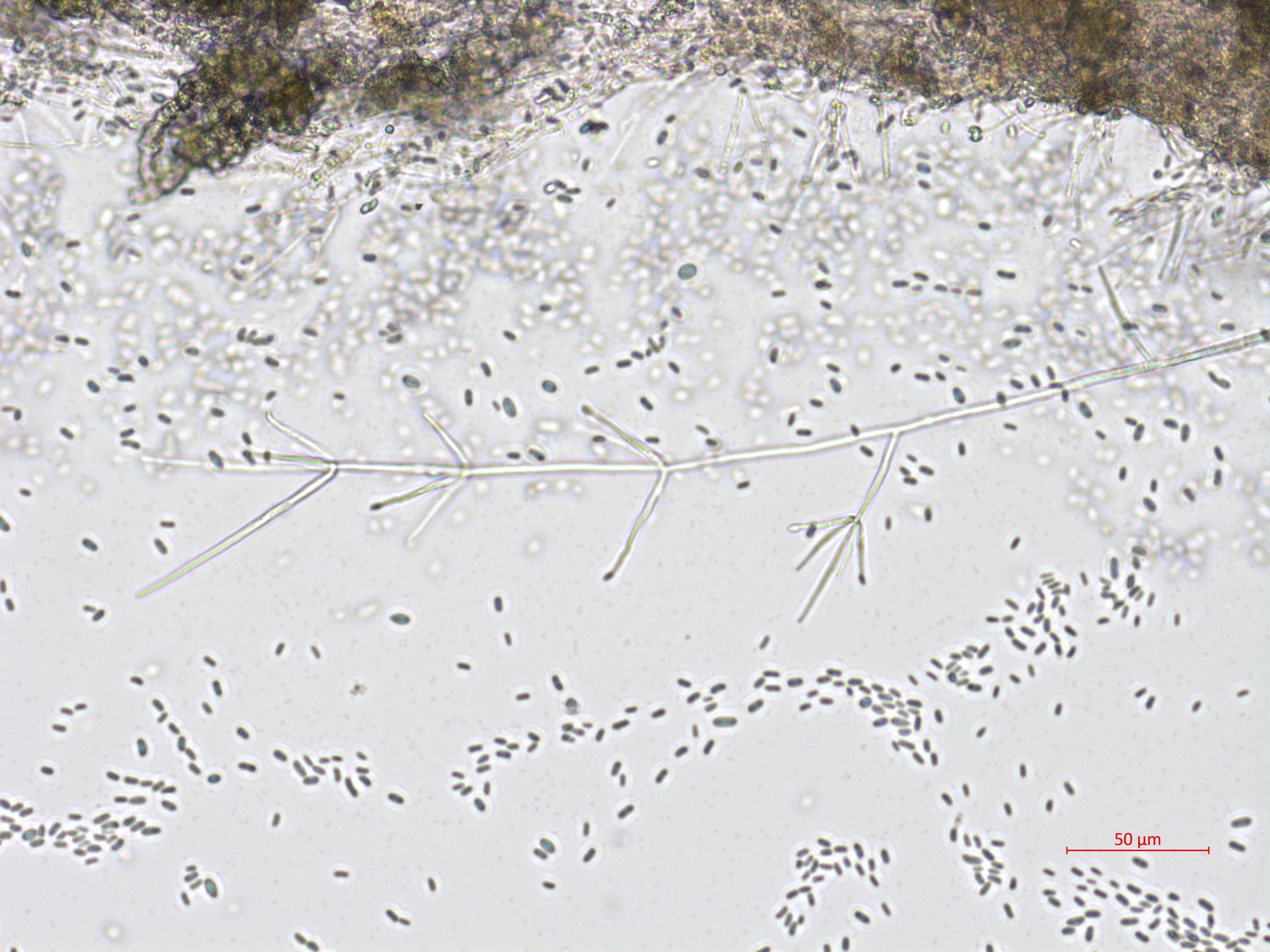Verticillium_dahliae_3