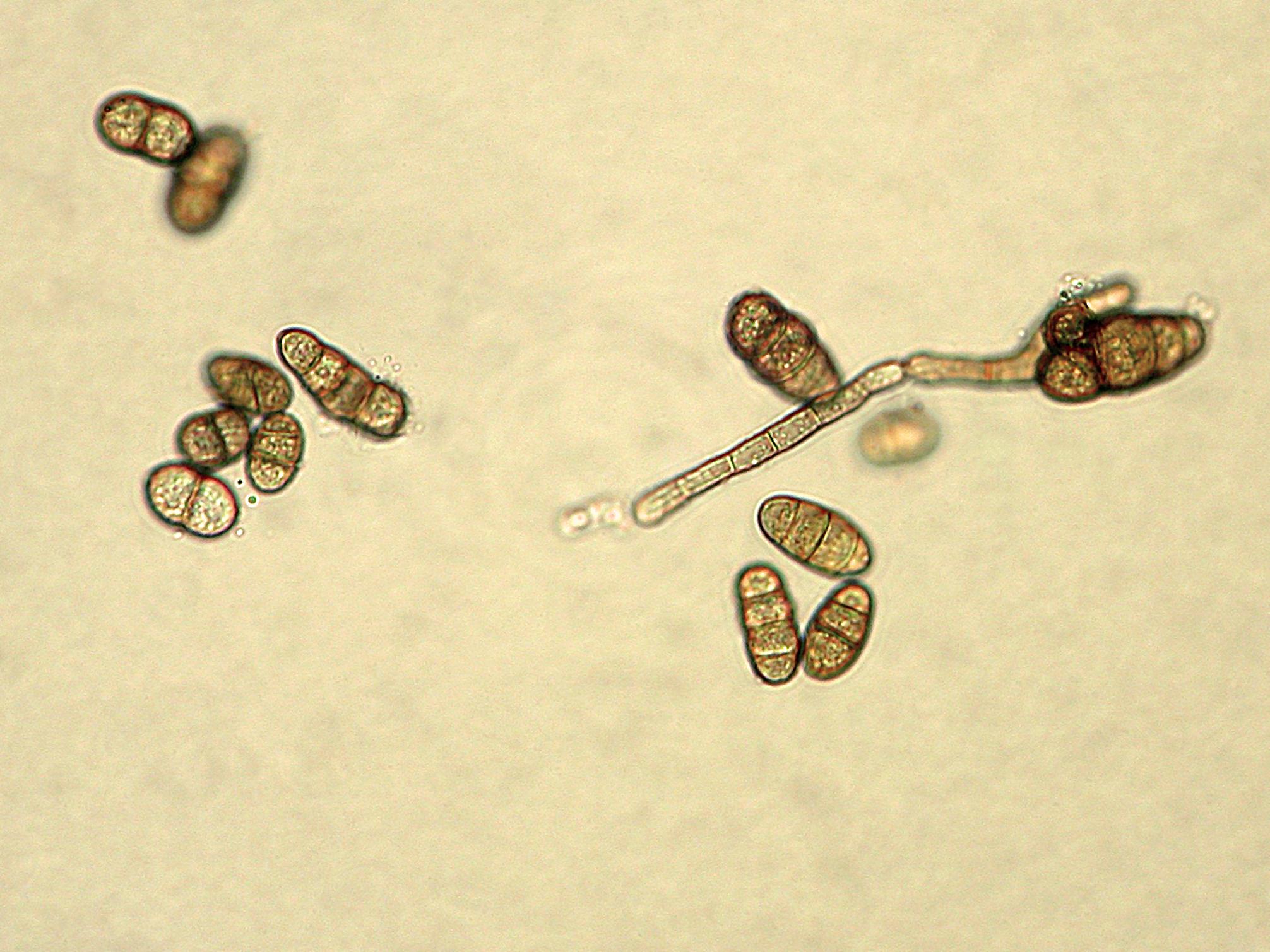 Ulocladium_sp_5