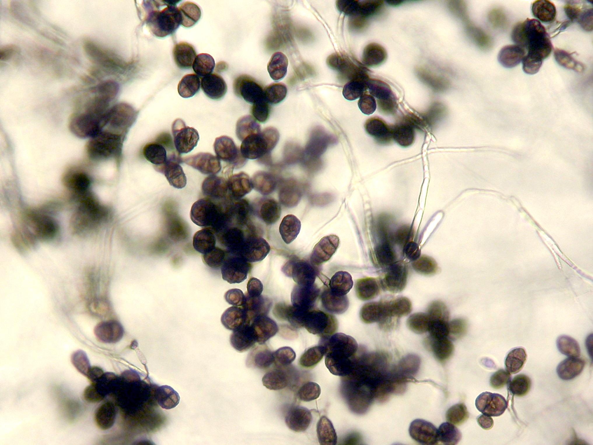 Ulocladium_sp_4