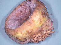 Céleri-rave - Moisissure grise (Botrytis cinerea)