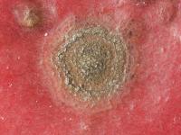Pomme - Tavelure (Venturia inaequalis)_10