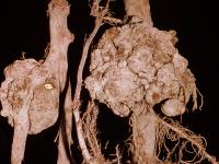 Pomme - Tumeur du collet (Agrobacterium tumefaciens)