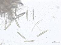 Phyllachora maydis