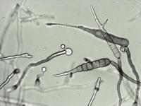 Conidie d'Alternaria solani