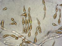 Alternaria_alternata-02_LQ