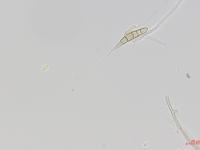 Alternaria_rostrum_D46202-1_LQ.jpg