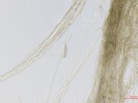 Alternaria_rostrum_D46202-2_LQ.jpg