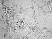 Aureobasidium-01_LQ