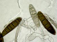 Bipolaris-03_LQ