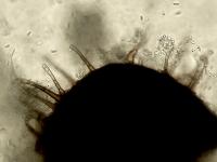 Chaetomella-04_LQ