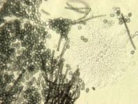 Chaetomium-11_LQ