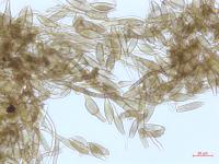 Cladosporium_D52838-2_LQ