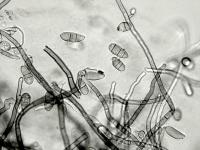 Cladosporium_brassicae-01