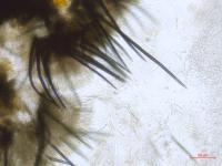 Colletotrichum_D52185_LQ