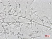 Colletotrichum_coccodes_D35079-1_LQ
