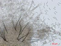 Colletotrichum_coccodes_D35079-2_LQ