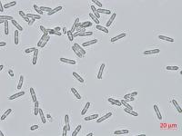 Colletotrichum_coccodes_D35079-3_LQ