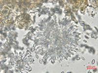 Coniella_diplodiella_D33070-1_LQ