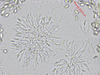 Coniella_diplodiella_D33070-4