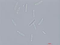 Cylindrocarpon_D27080-1_LQ