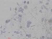 Cylindrocarpon_D27080-2_LQ