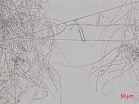 Cylindrocarpon_D44139_LQ