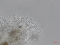 Cytospora_leucostoma_D44677-2_Conidiophores_LQ