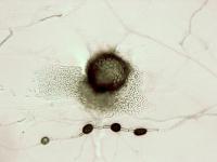 ascochyta_medicaginicola-01-ret