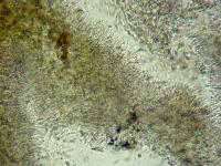 cytospora-09-ret