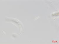 Fusarium_equiseti_2