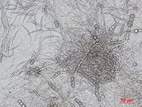 Fusarium_equiseti_3