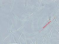 Fusarium_equiseti_4