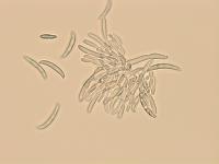 Fusarium_sp_3