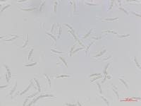 Fusarium_oxysporum_3