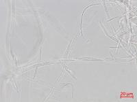 Fusarium_proliferatum_3