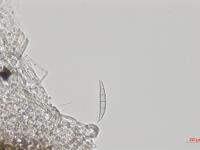 Fusarium_sp_4