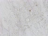 Geotrichum_sp_2
