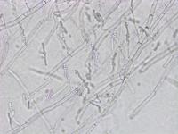 Geotrichum_sp_3